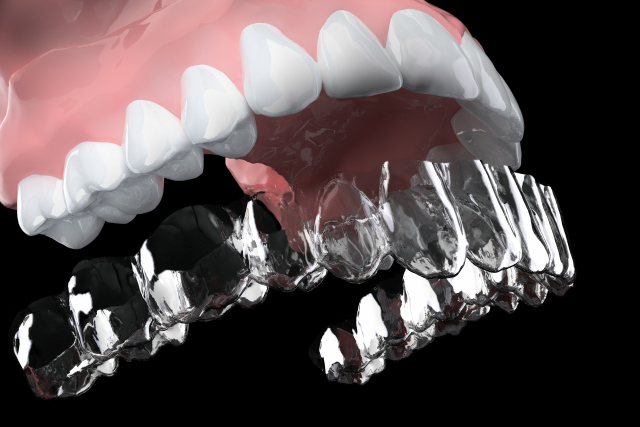 歯列矯正で歯が動きやすい人の特徴とは？